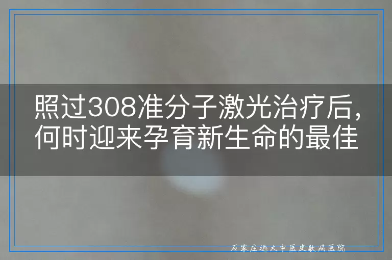 照过308准分子激光治疗后，何时迎来孕育新生命的最佳时机？