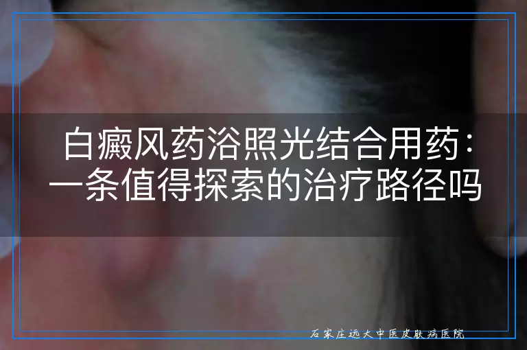 白癜风药浴照光结合用药：一条值得探索的治疗路径吗？