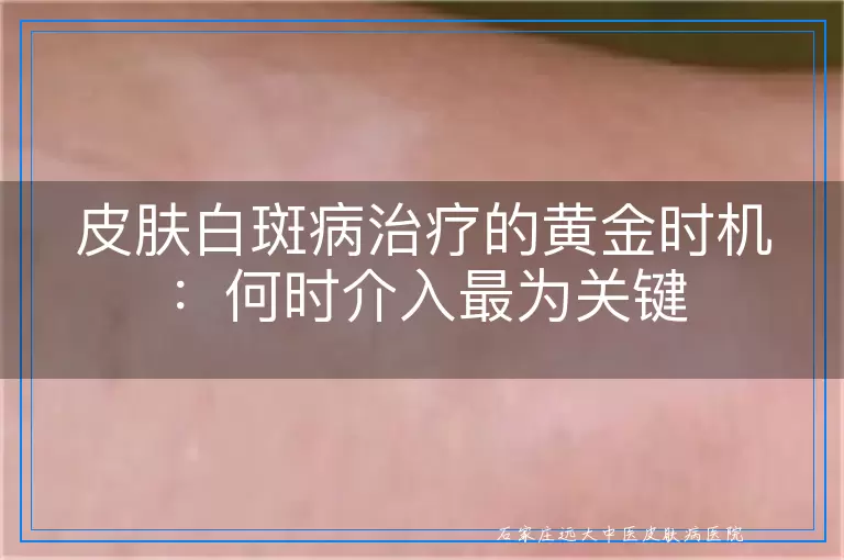 白癜风起泡后应等待消退再进行激光治疗吗？多维度视角解析