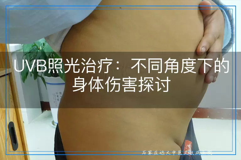 UVB照光治疗：不同角度下的身体伤害探讨