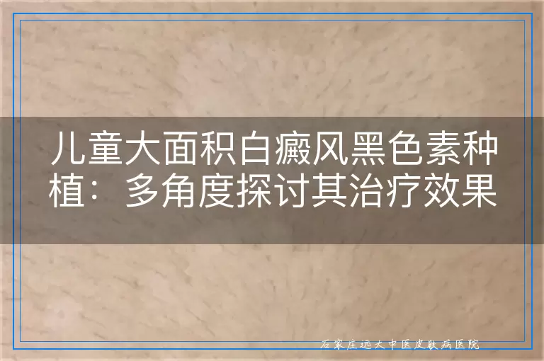 儿童大面积白癜风黑色素种植：多角度探讨其治疗效果与注意事项