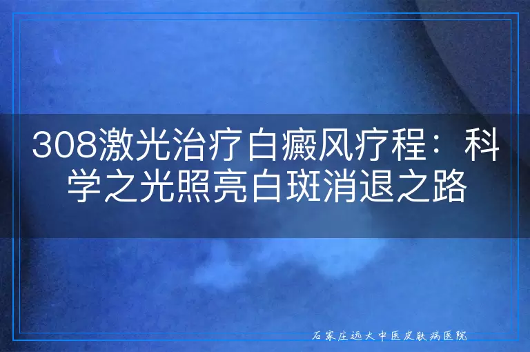 308激光治疗白癜风疗程：科学之光照亮白斑消退之路