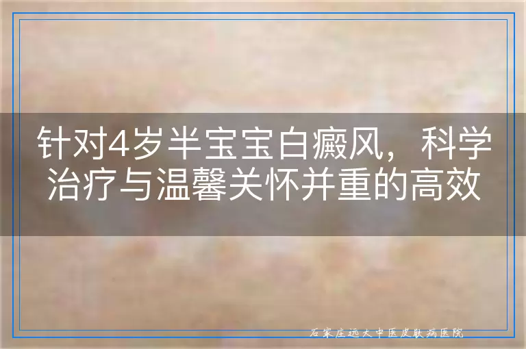 针对4岁半宝宝白癜风，科学治疗与温馨关怀并重的高效方案