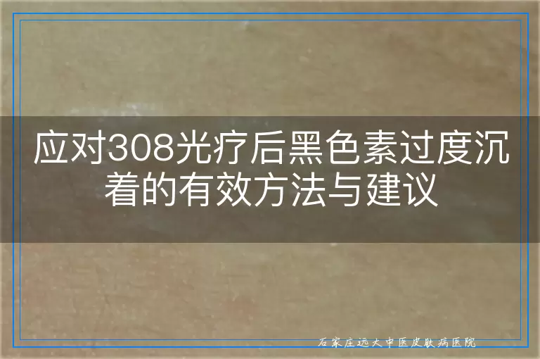 应对308光疗后黑色素过度沉着的有效方法与建议
