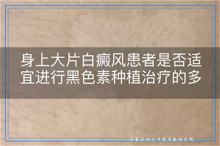 身上大片白癜风患者是否适宜进行黑色素种植治疗的多维度考量