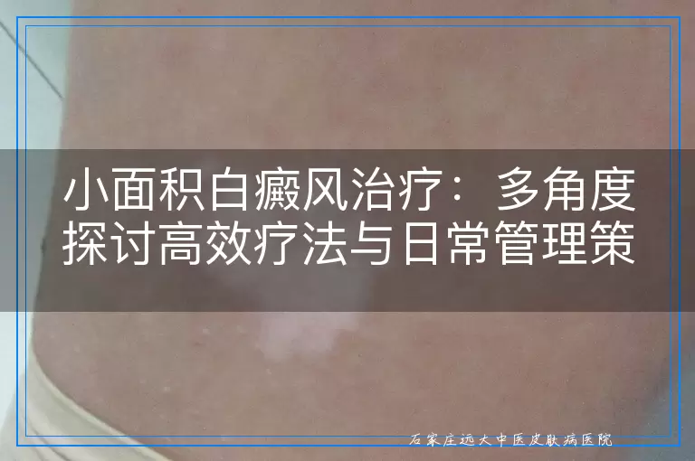 小面积白癜风治疗：多角度探讨高效疗法与日常管理策略