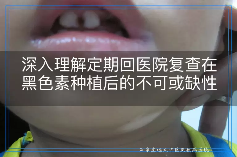 深入理解定期回医院复查在黑色素种植后的不可或缺性：从医疗监督到心理支持的全方位视角
