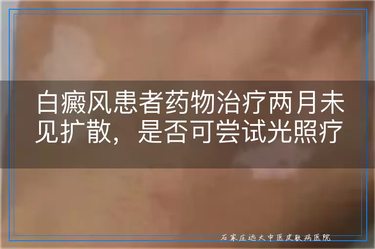 白癜风患者药物治疗两月未见扩散，是否可尝试光照疗法辅助康复？