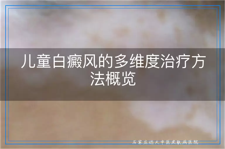 儿童白癜风的多维度治疗方法概览