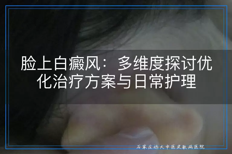 脸上白癜风：多维度探讨优化治疗方案与日常护理