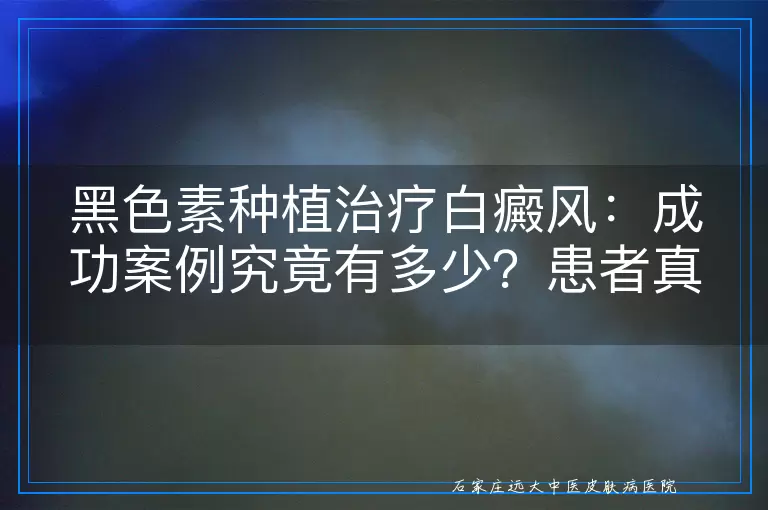 黑色素种植治疗白癜风：成功案例究竟有多少？患者真实反馈与效果评估
