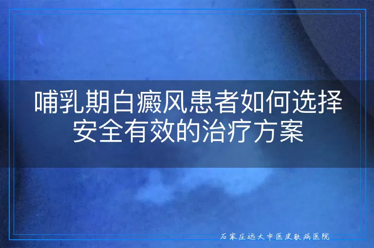 哺乳期白癜风患者如何选择安全有效的治疗方案