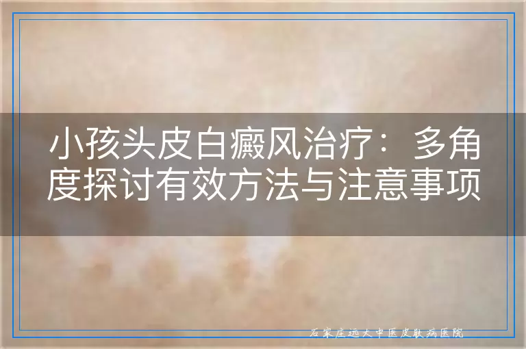 小孩头皮白癜风治疗：多角度探讨有效方法与注意事项