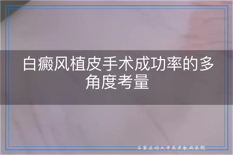 白癜风植皮手术成功率的多角度考量