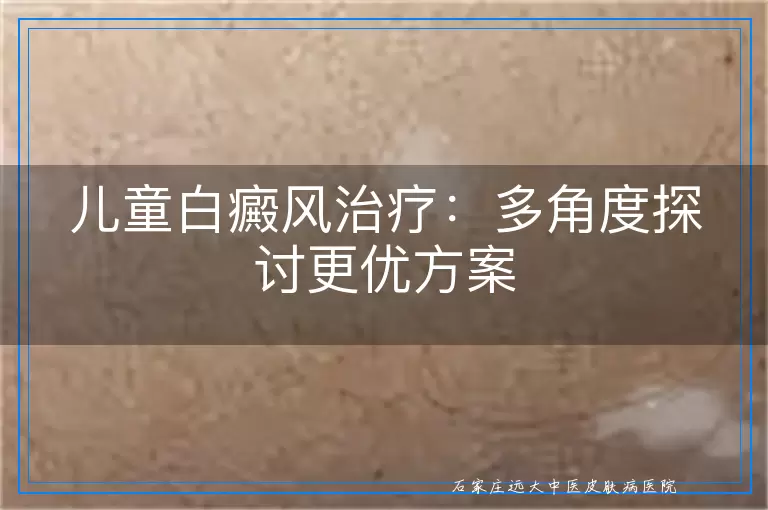 儿童白癜风治疗：多角度探讨更优方案