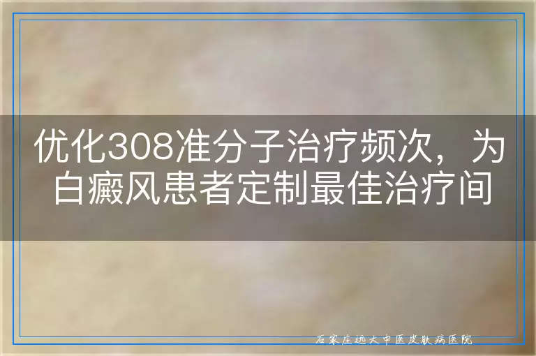 优化308准分子治疗频次，为白癜风患者定制最佳治疗间隔