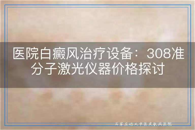 医院白癜风治疗设备：308准分子激光仪器价格探讨