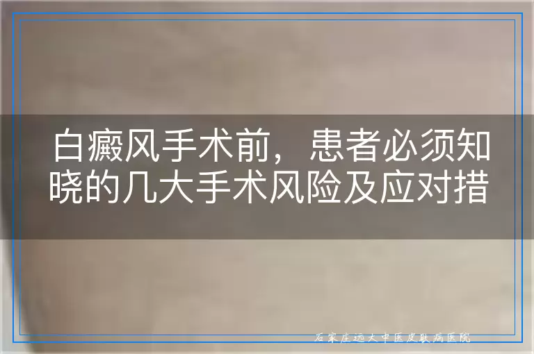 白癜风手术前，患者必须知晓的几大手术风险及应对措施