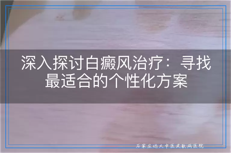 深入探讨白癜风治疗：寻找最适合的个性化方案
