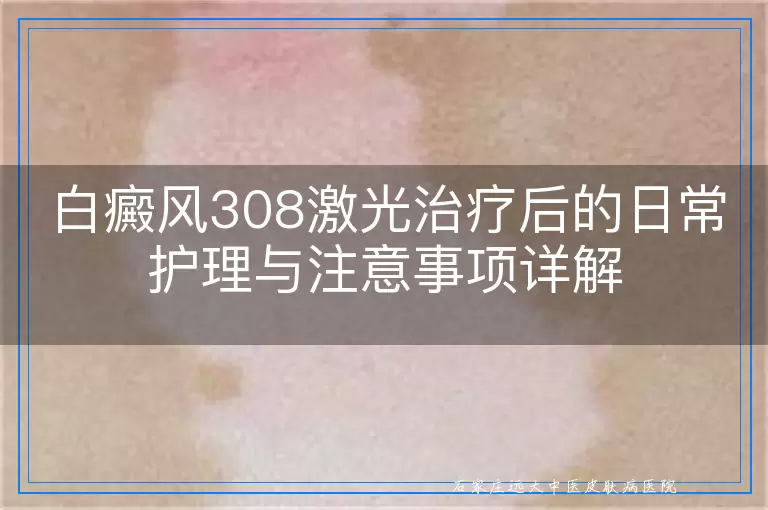 白癜风308激光治疗后的日常护理与注意事项详解