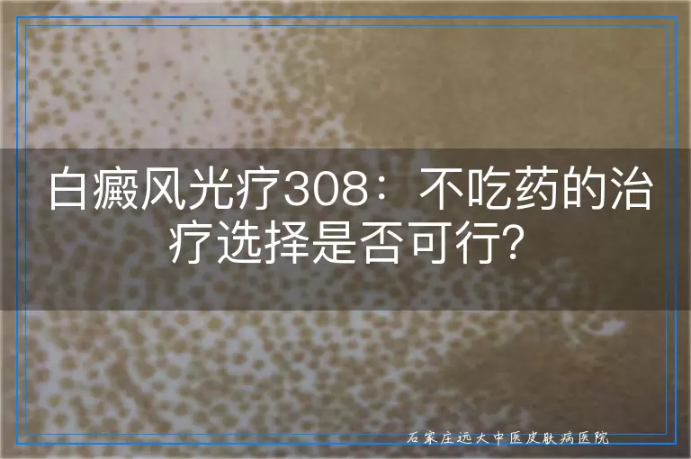 白癜风光疗308：不吃药的治疗选择是否可行？