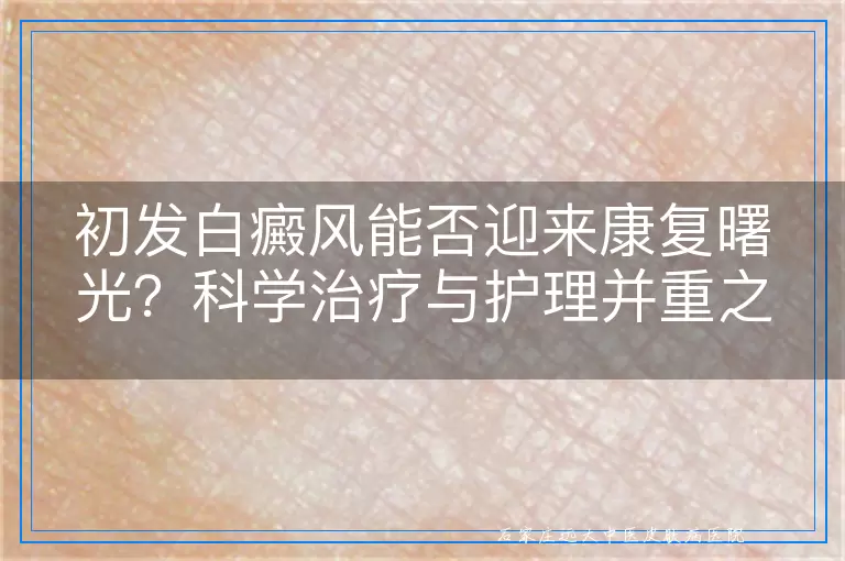 初发白癜风能否迎来康复曙光？科学治疗与护理并重之道