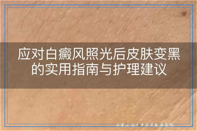 应对白癜风照光后皮肤变黑的实用指南与护理建议