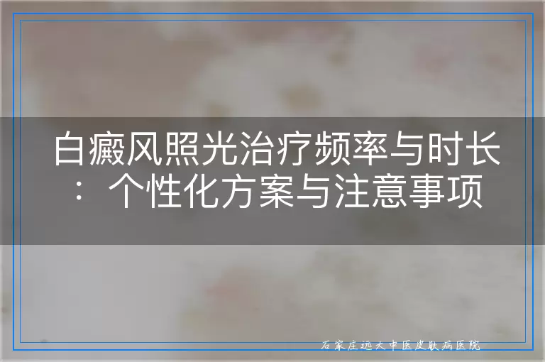 白癜风照光治疗频率与时长：个性化方案与注意事项