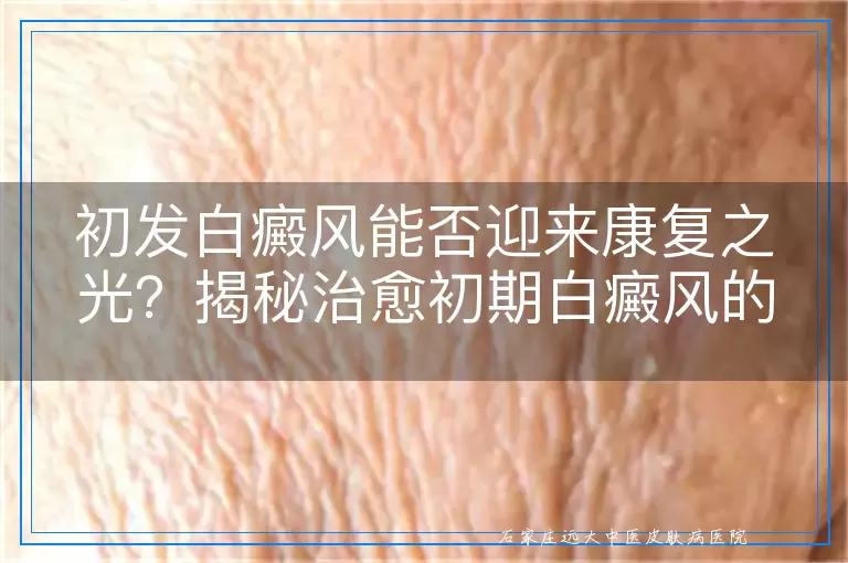 初发白癜风能否迎来康复之光？揭秘治愈初期白癜风的多元途径
