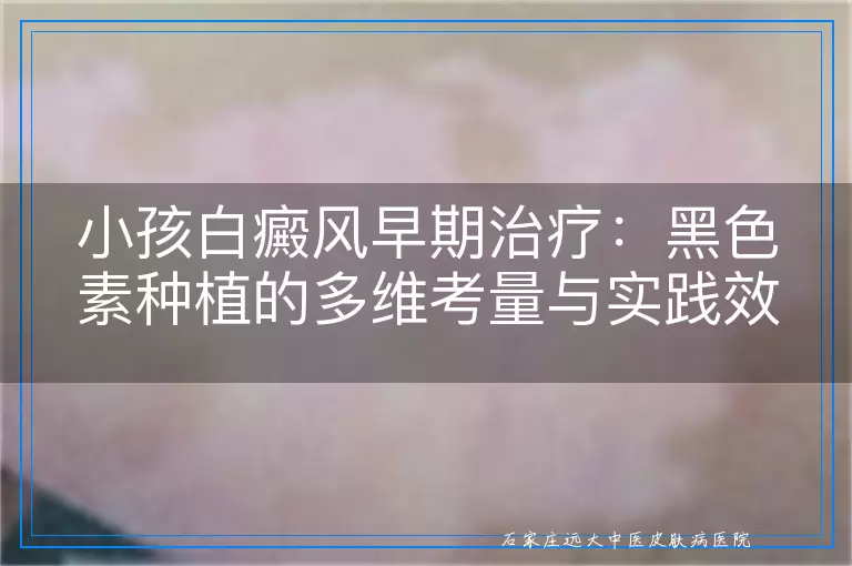 小孩白癜风早期治疗：黑色素种植的多维考量与实践效果