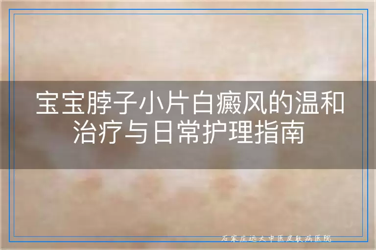 宝宝脖子小片白癜风的温和治疗与日常护理指南
