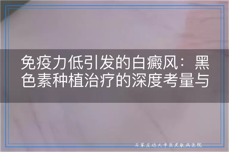 免疫力低引发的白癜风：黑色素种植治疗的深度考量与效果展望