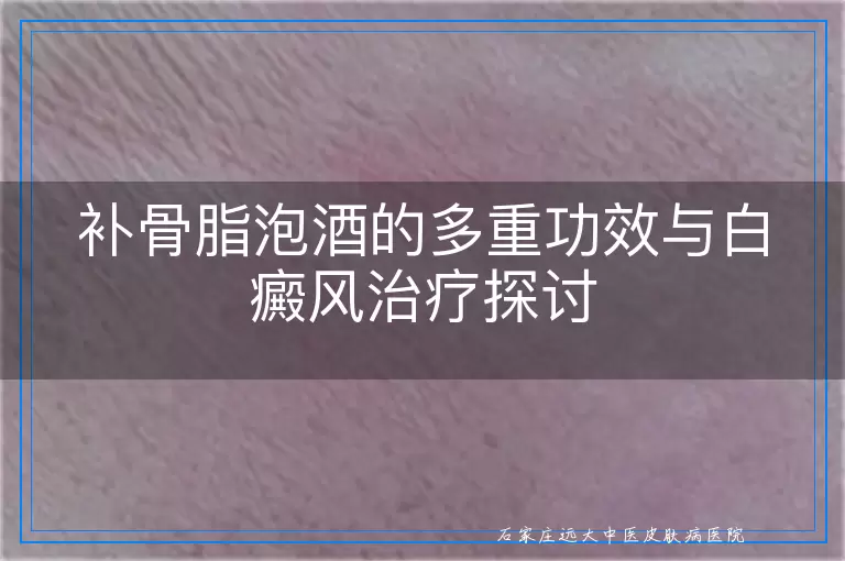 补骨脂泡酒的多重功效与白癜风治疗探讨