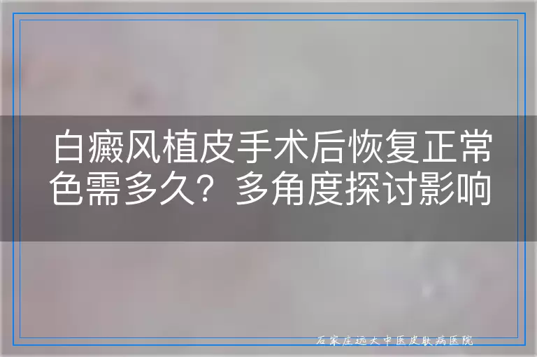 白癜风植皮手术后恢复正常色需多久？多角度探讨影响因素