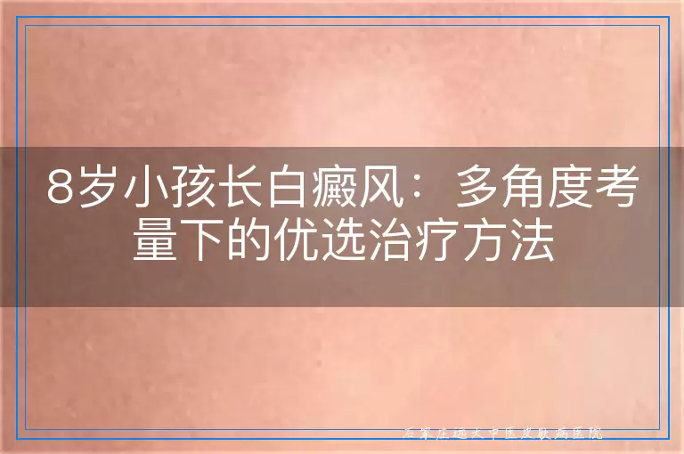 8岁小孩长白癜风：多角度考量下的优选治疗方法