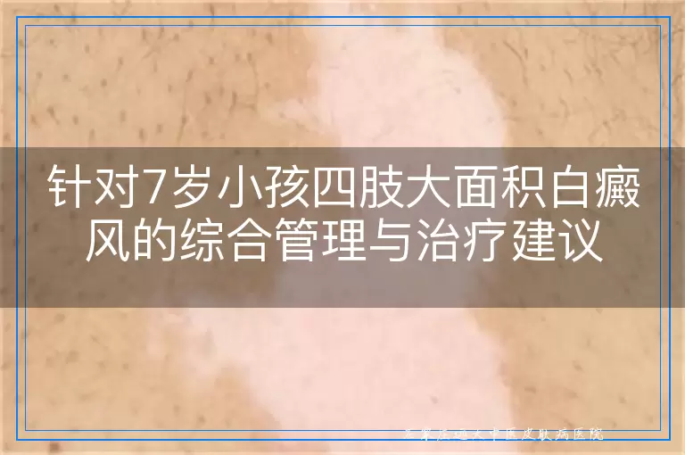 针对7岁小孩四肢大面积白癜风的综合管理与治疗建议