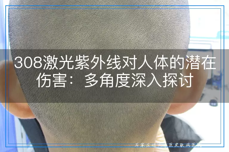 308激光紫外线对人体的潜在伤害：多角度深入探讨