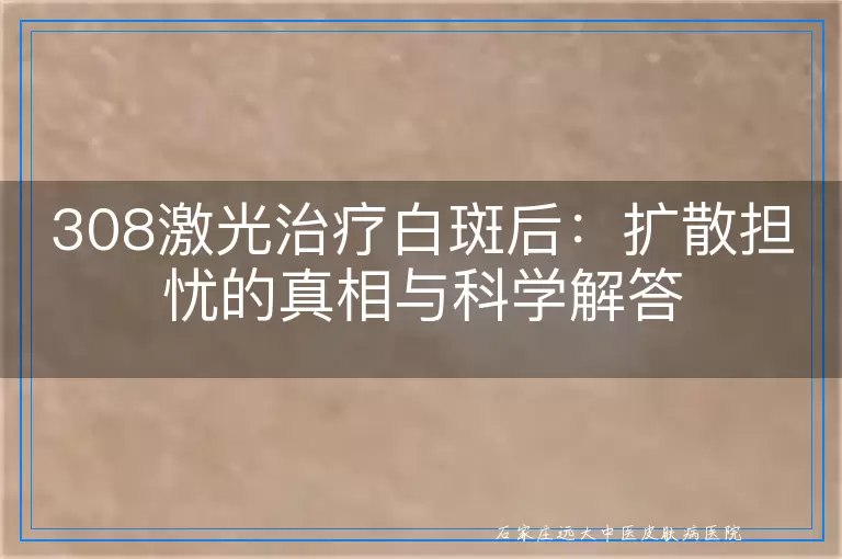 308激光治疗白斑后：扩散担忧的真相与科学解答