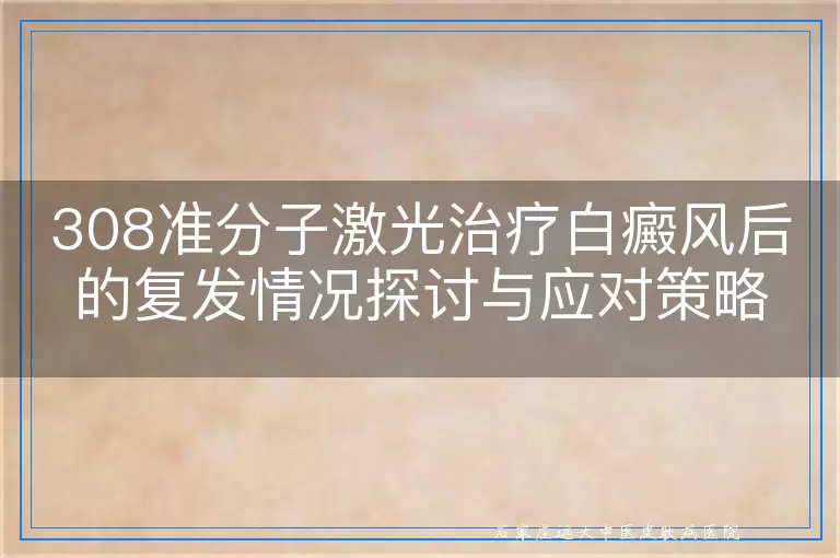 308准分子激光治疗白癜风后的复发情况探讨与应对策略