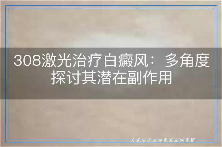 308激光治疗白癜风：多角度探讨其潜在副作用