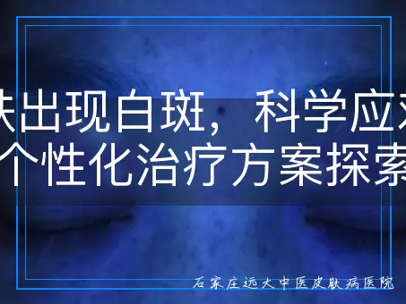 皮肤出现白斑，科学应对与个性化治疗方案探索