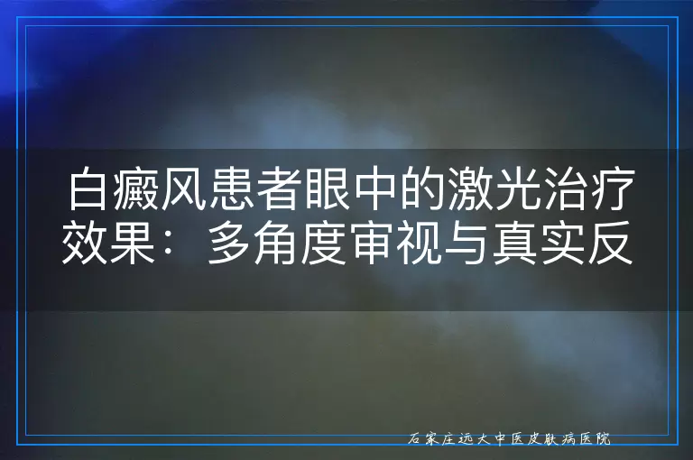 白癜风患者眼中的激光治疗效果：多角度审视与真实反馈