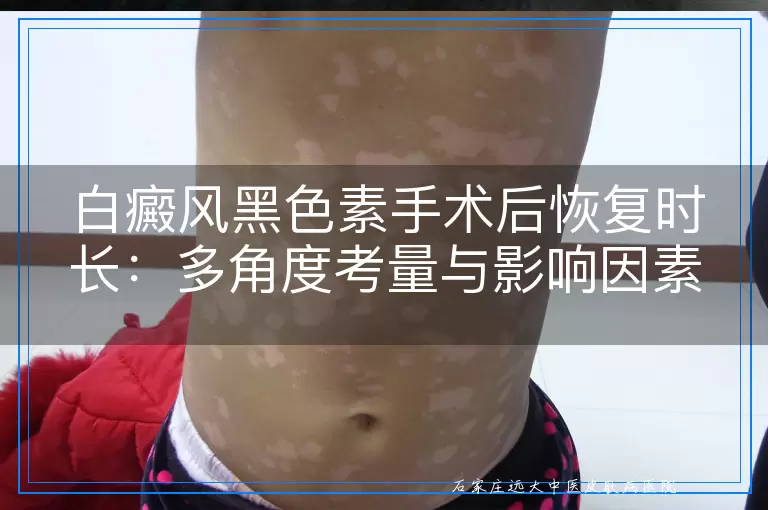 白癜风黑色素手术后恢复时长：多角度考量与影响因素