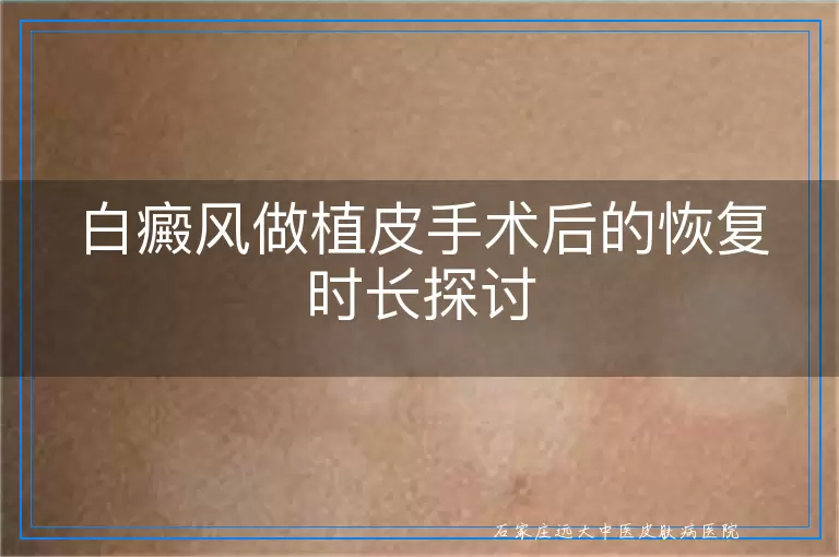 白癜风做植皮手术后的恢复时长探讨