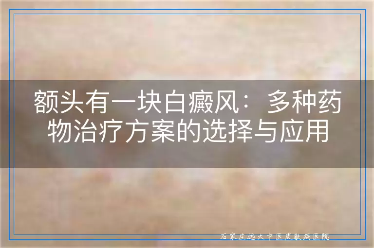 额头有一块白癜风：多种药物治疗方案的选择与应用