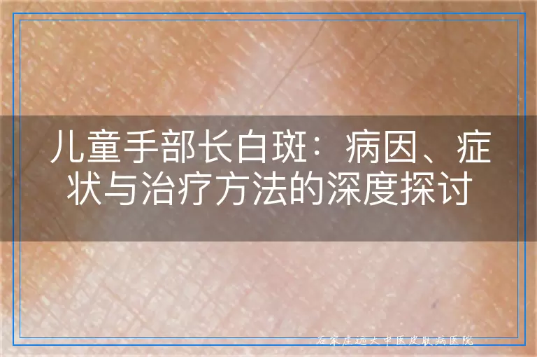 儿童手部长白斑：病因、症状与治疗方法的深度探讨