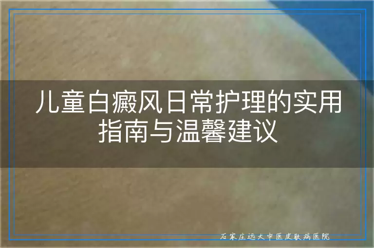 儿童白癜风日常护理的实用指南与温馨建议