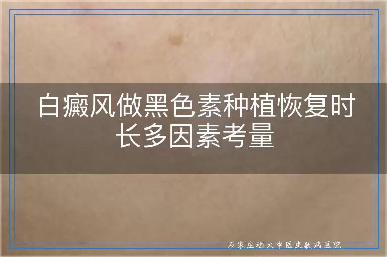 白癜风做黑色素种植恢复时长多因素考量