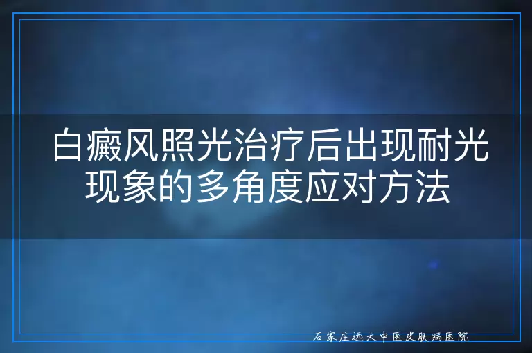 白癜风照光治疗后出现耐光现象的多角度应对方法