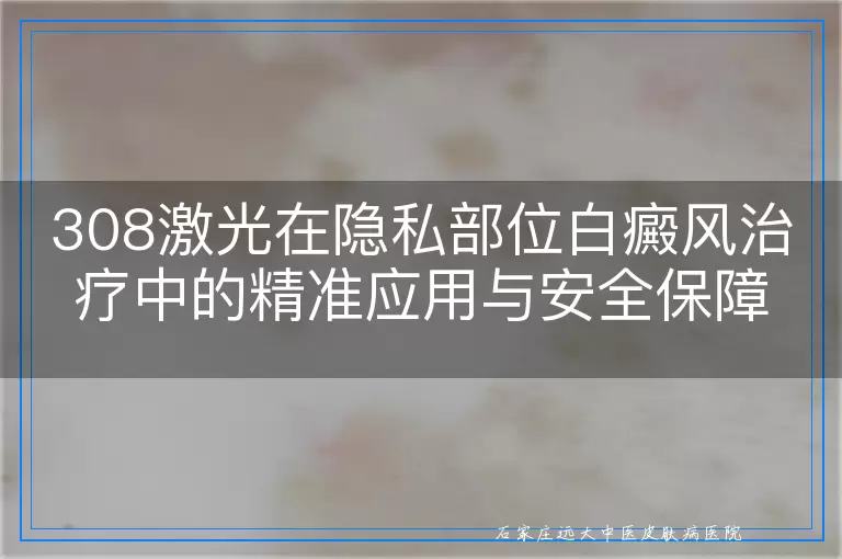 308激光在隐私部位白癜风治疗中的精准应用与安全保障